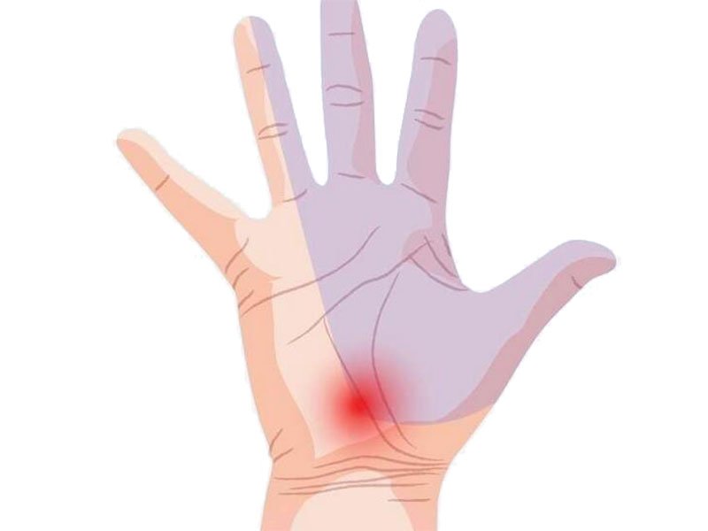 Pain In Palm Of Hand