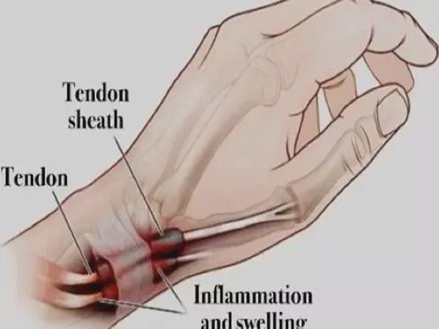 wrist pain